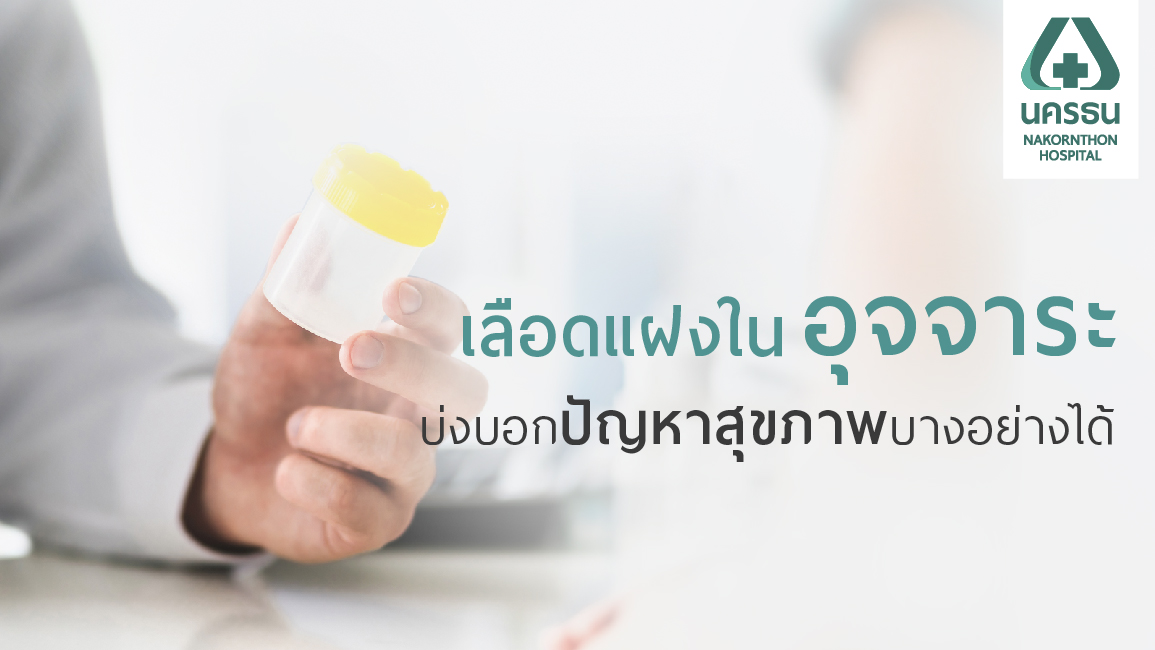 การตรวจหาเลือดแฝงในอุจจาระ คัดกรองโรคทางเดินอาหาร